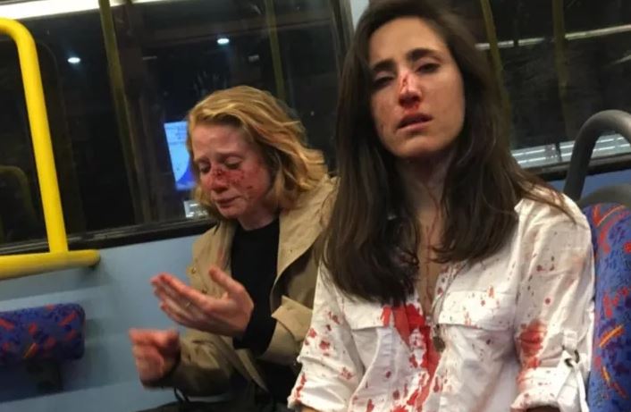 Dos jóvenes lesbianas son brutalmente golpeadas en Londres 1