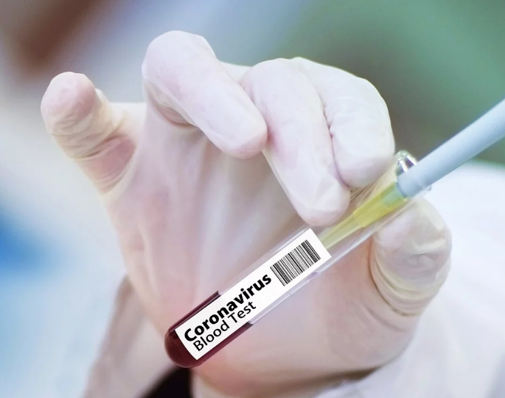 Sanidad reconoce que compró 50.000 test erróneos de detección de COVID-19 El Ministerio de Sanidad reconoce que compró al menos un total de 50.000 test rápidos y no  solo los 9.000 que dijo en un principio.
