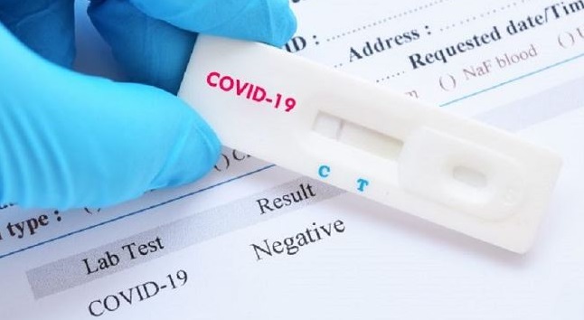 Comienzan las pruebas de detección de COVID-19 mediante PCRs