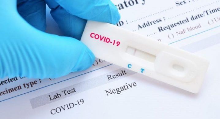 Test antígenos Covid-19