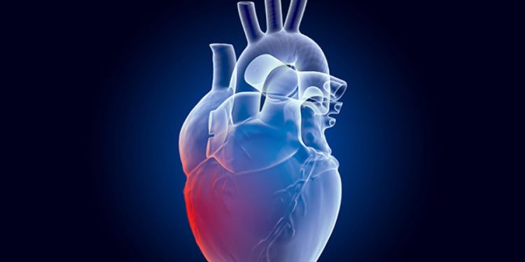 Causas y prevención de infartos y otros problemas del corazón 1