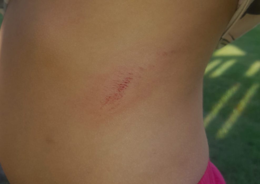 El mal estado de un parque causa heridas en una niña 1